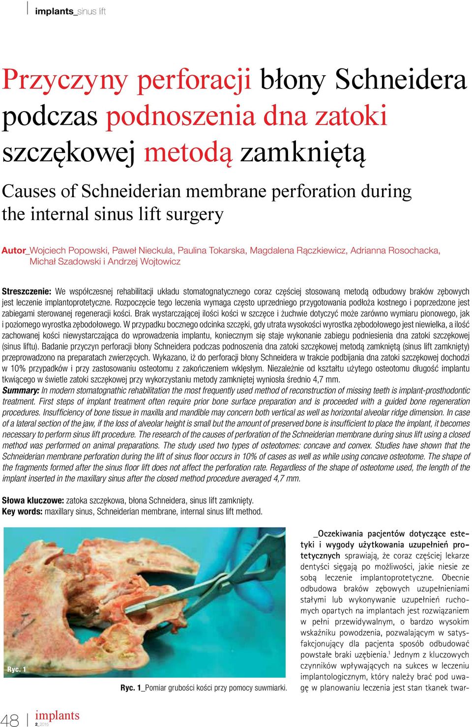 stomatognatycznego coraz częściej stosowaną metodą odbudowy braków zębowych jest leczenie implantoprotetyczne.