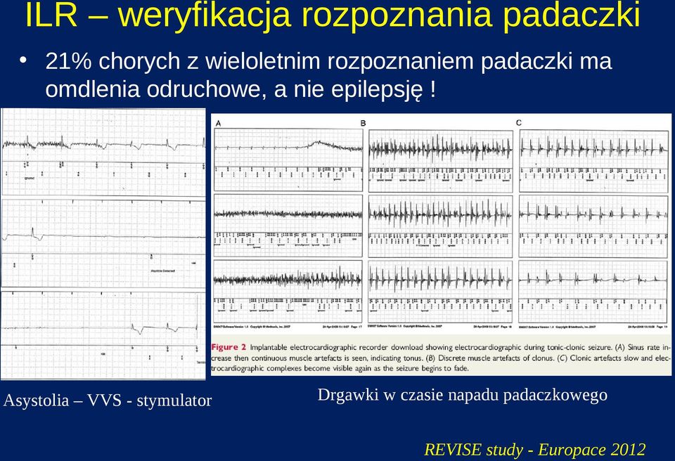 odruchowe, a nie epilepsję!