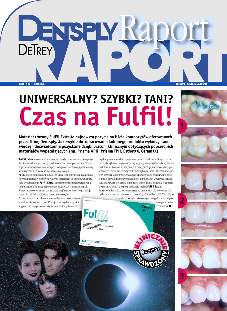 Materiał złożony FulFil Extra to najnowsza pozycja na liście kompozytów oferowanych przez firmę Dentsply.