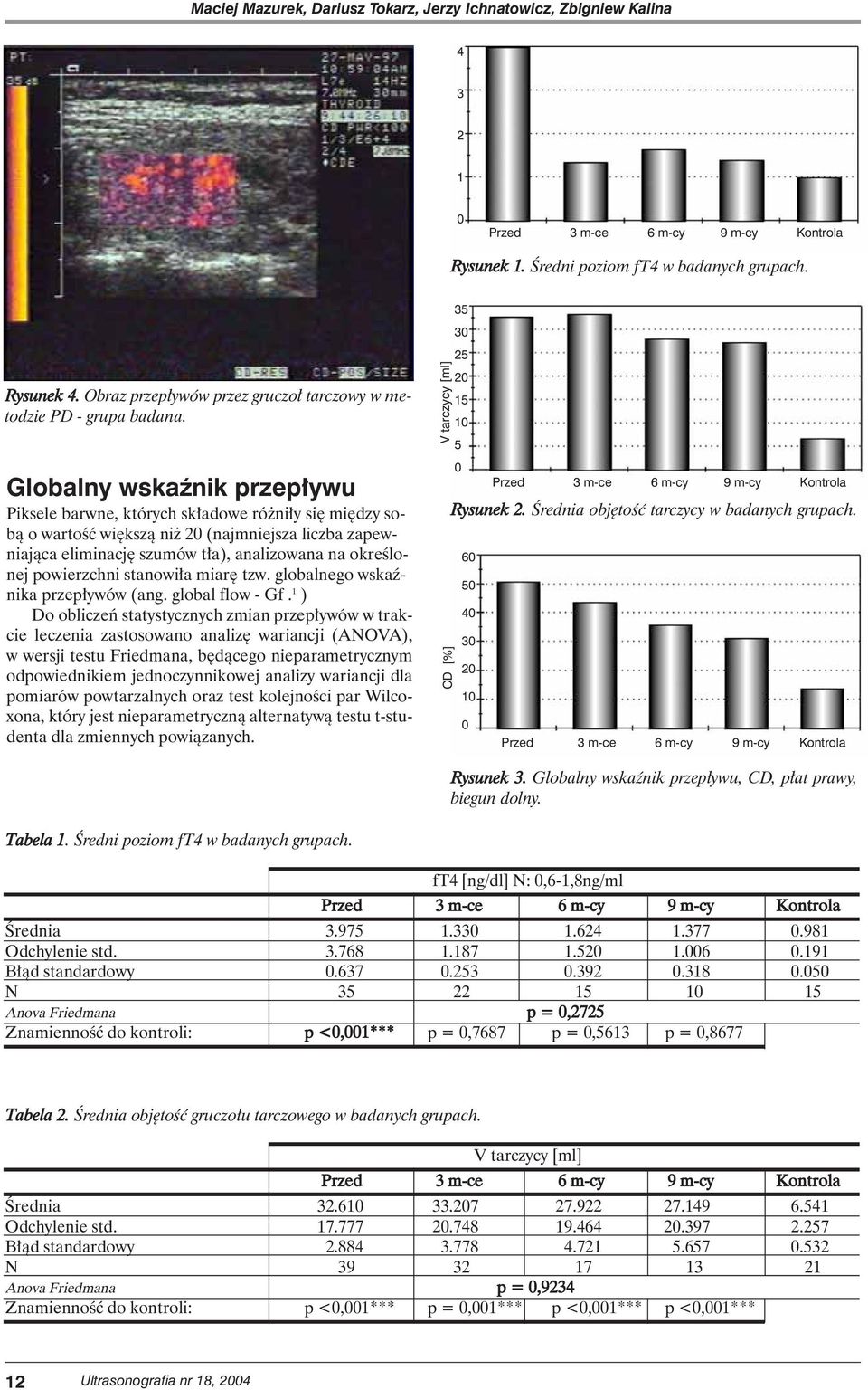 Globalny wskaênik przep ywu Piksele barwne, których sk adowe ró ni y si mi dzy sobà o wartoêç wi kszà ni 20 (najmniejsza liczba zapewniajàca eliminacj szumów t a), analizowana na okreêlonej