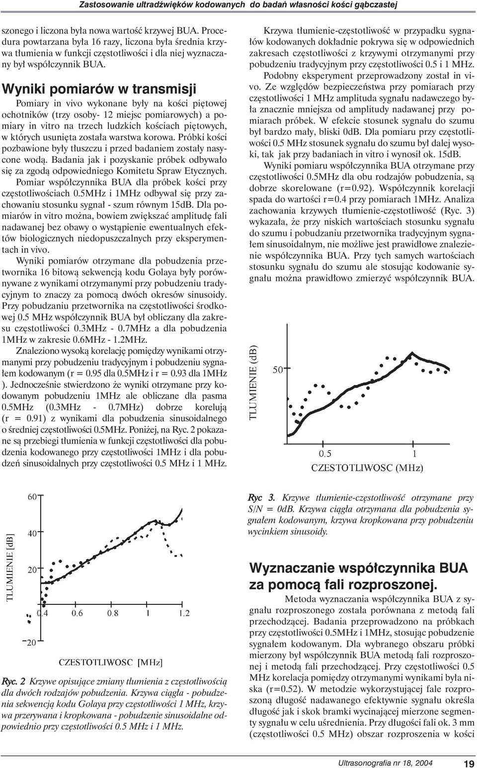 Wyniki pomiarów w transmisji Pomiary in vivo wykonane by y na koêci pi towej ochotników (trzy osoby- 12 miejsc pomiarowych) a pomiary in vitro na trzech ludzkich koêciach pi towych, w których usuni