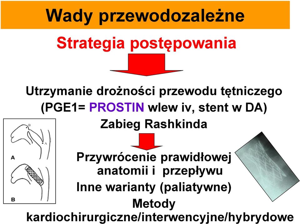 Rashkinda Przywrócenie prawidłowej anatomii i przepływu Inne