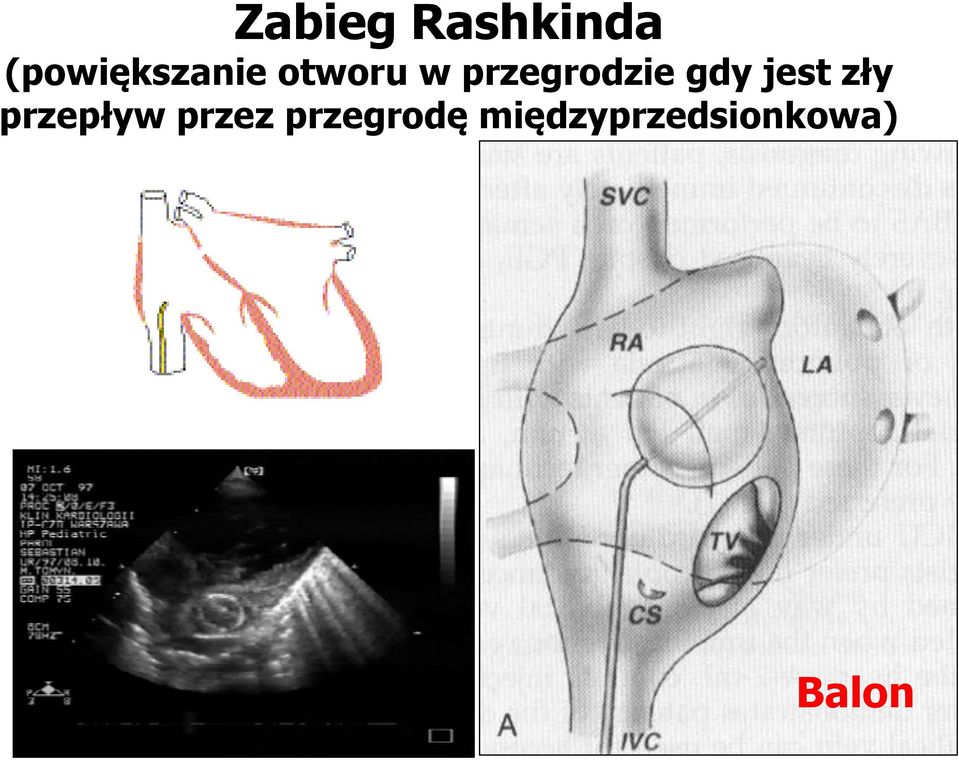 przegrodzie gdy jest zły