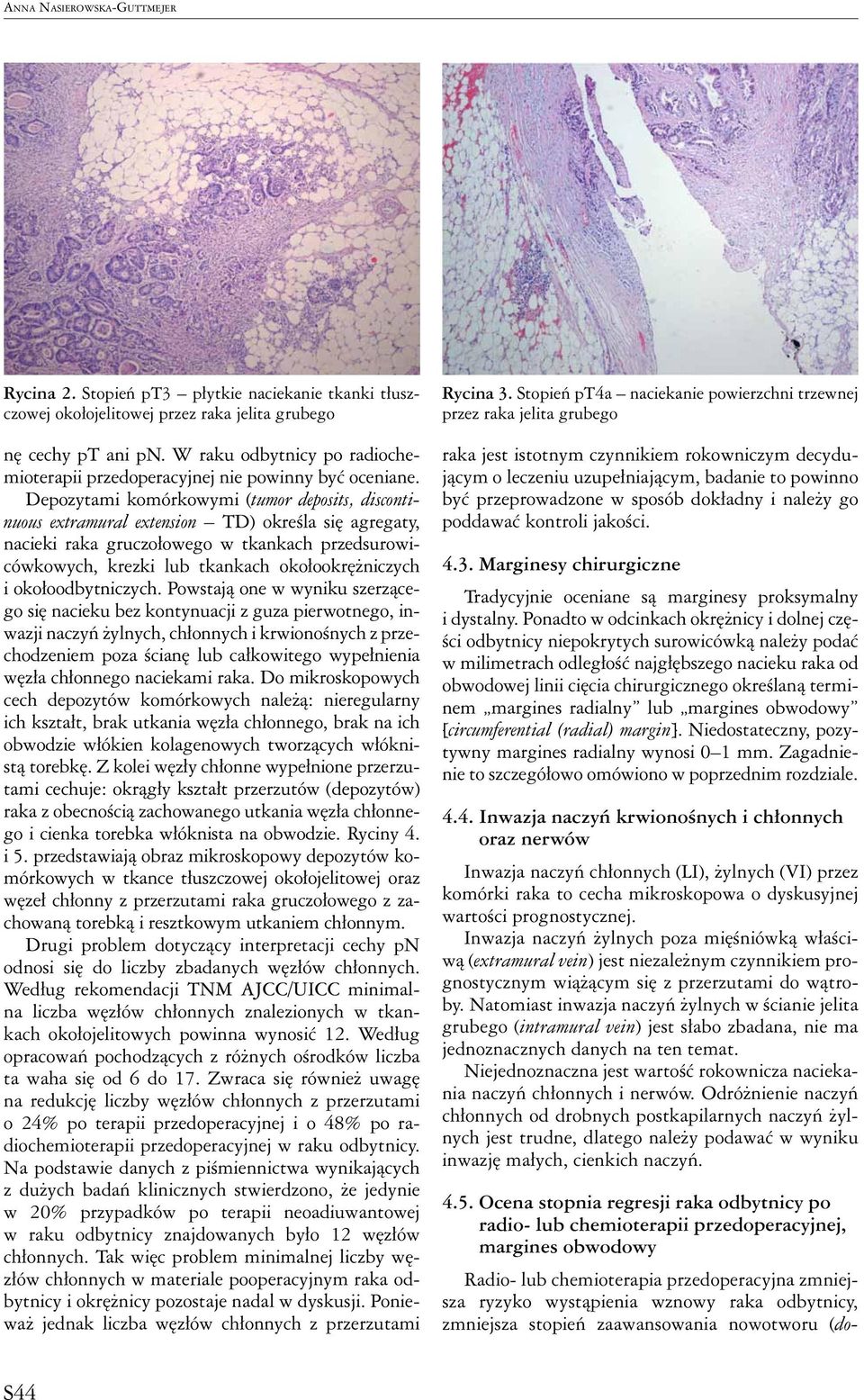 Depozytami komórkowymi (tumor deposits, discontinuous extramural extension TD) określa się agregaty, nacieki raka gruczołowego w tkankach przedsurowicówkowych, krezki lub tkankach okołookrężniczych i