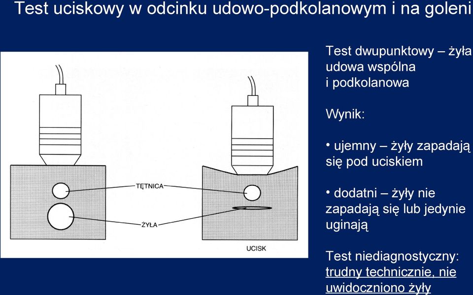 zapadają się pod uciskiem dodatni żyły nie zapadają się lub