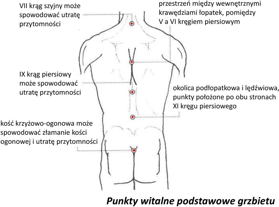 okolica podłopatkowa i lędźwiowa, punkty położone po obu stronach XI kręgu piersiowego kośd