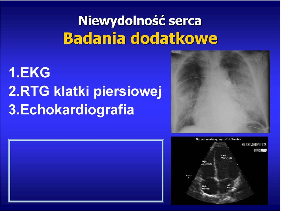 EKG 2.