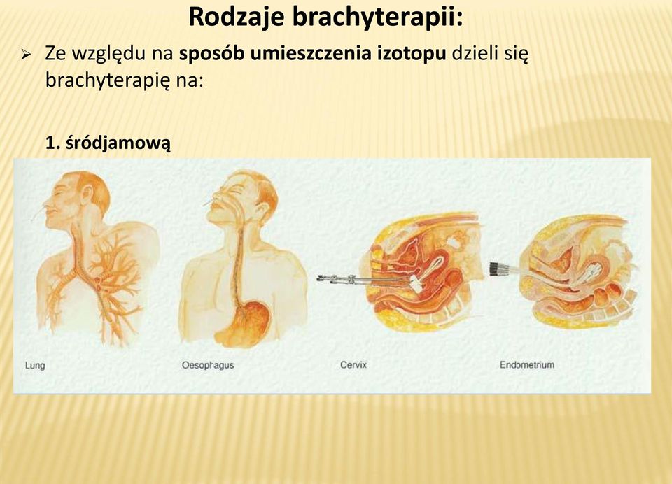 umieszczenia izotopu