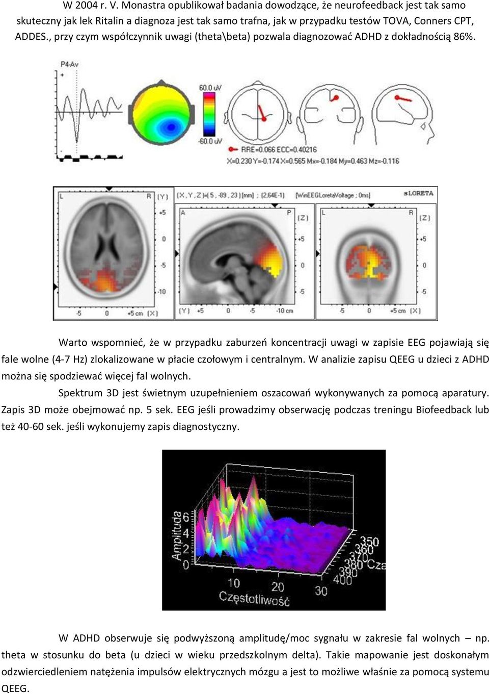 Warto wspomnieć, że w przypadku zaburzeń koncentracji uwagi w zapisie EEG pojawiają się fale wolne (4-7 Hz) zlokalizowane w płacie czołowym i centralnym.