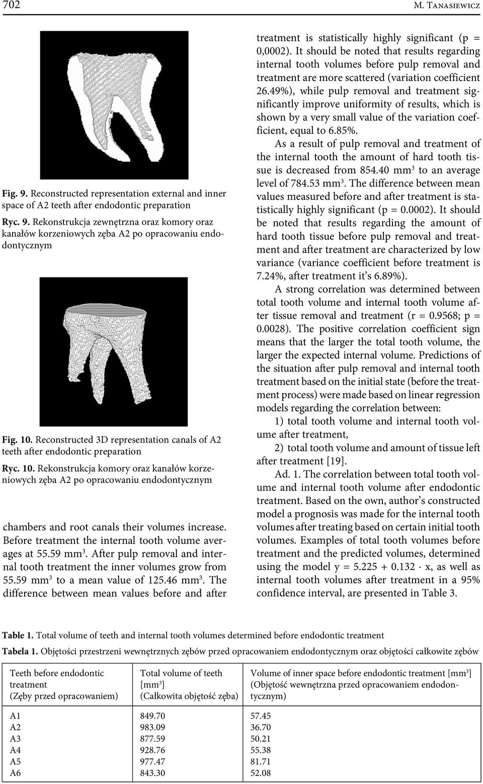 Rekonstrukcja komory oraz kanałów korzeniowych zęba A2 po opracowaniu endodontycznym chambers and root canals their volumes increase. Before treatment the internal tooth volume averages at 55.59 mm 3.