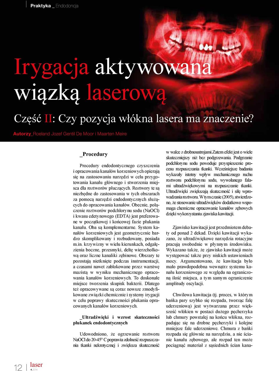 kanału głównego i stworzenia miejsca dla roztworów płuczących. Roztwory te są niezbędne do zastosowania w tych obszarach za pomocą narzędzi endodontycznych służących do opracowania kanałów.