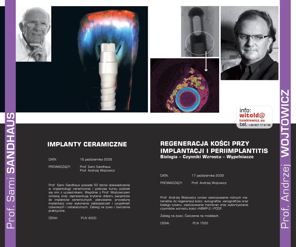 Wojtowiczem omówią oraz zaprezentują kryteria doboru pacjentów do implantów ceramicznych, planowanie, procedurę implantacji oraz wykonania zabezpieczeń i uzupełnień czasowych i ostatecznych.