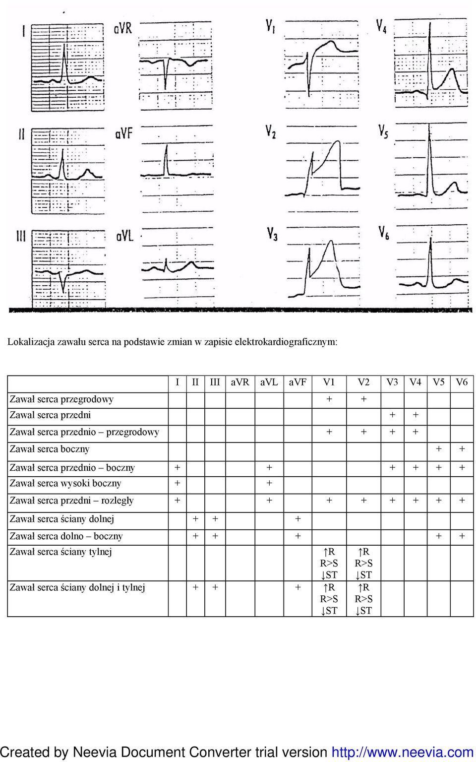 boczny + + + + + + Zawał serca wysoki boczny + + Zawał serca przedni rozległy + + + + + + + + Zawał serca ściany dolnej + + +