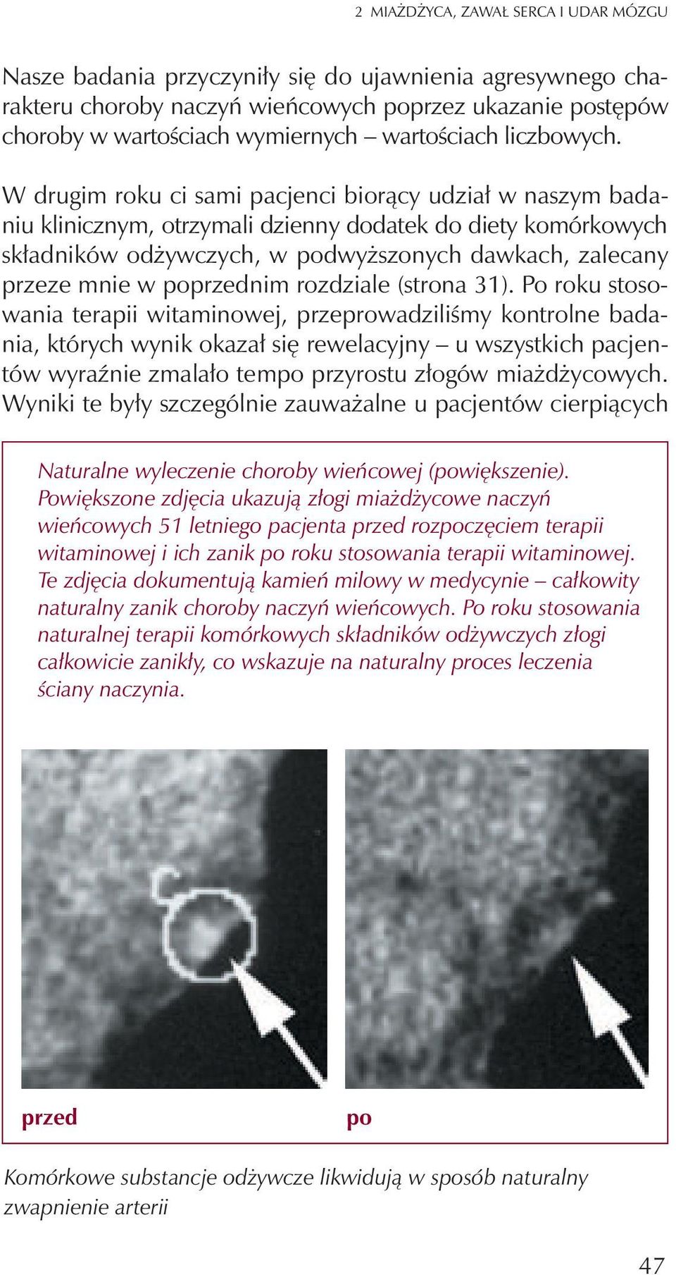 W drugim roku ci sami pacjenci bior¹cy udzia³ w naszym badaniu klinicznym, otrzymali dzienny dodatek do diety komórkowych sk³adników od ywczych, w podwy szonych dawkach, zalecany przeze mnie w