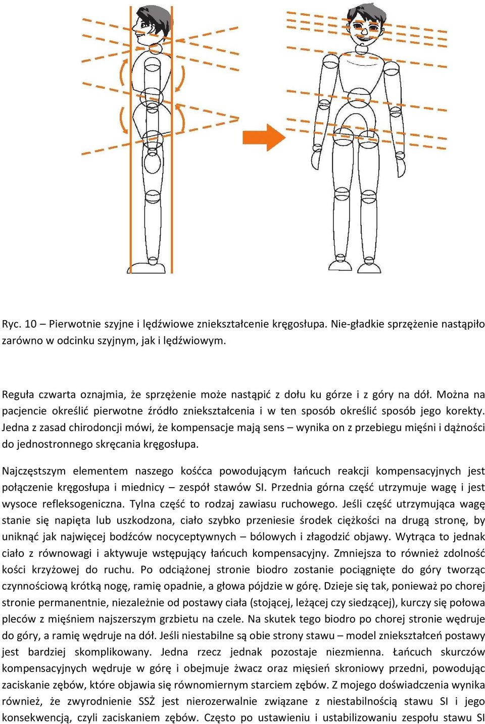 Jedna z zasad chirodoncji mówi, że kompensacje mają sens wynika on z przebiegu mięśni i dążności do jednostronnego skręcania kręgosłupa.