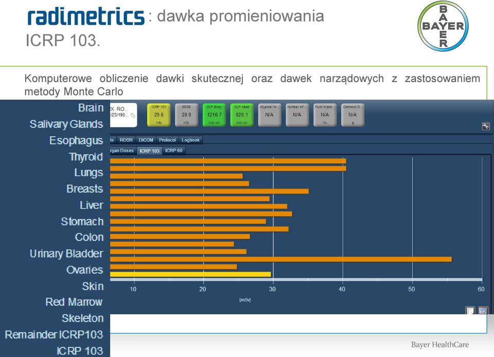 Komputerowe obliczenie dawki