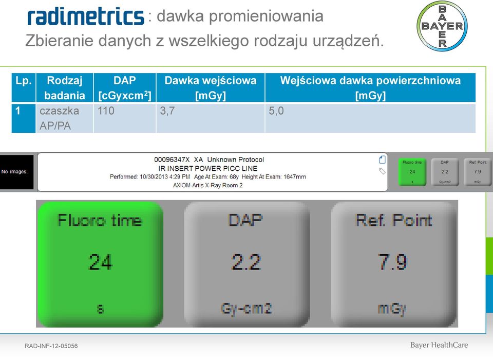 Rodzaj badania 1 czaszka AP/PA DAP Dawka