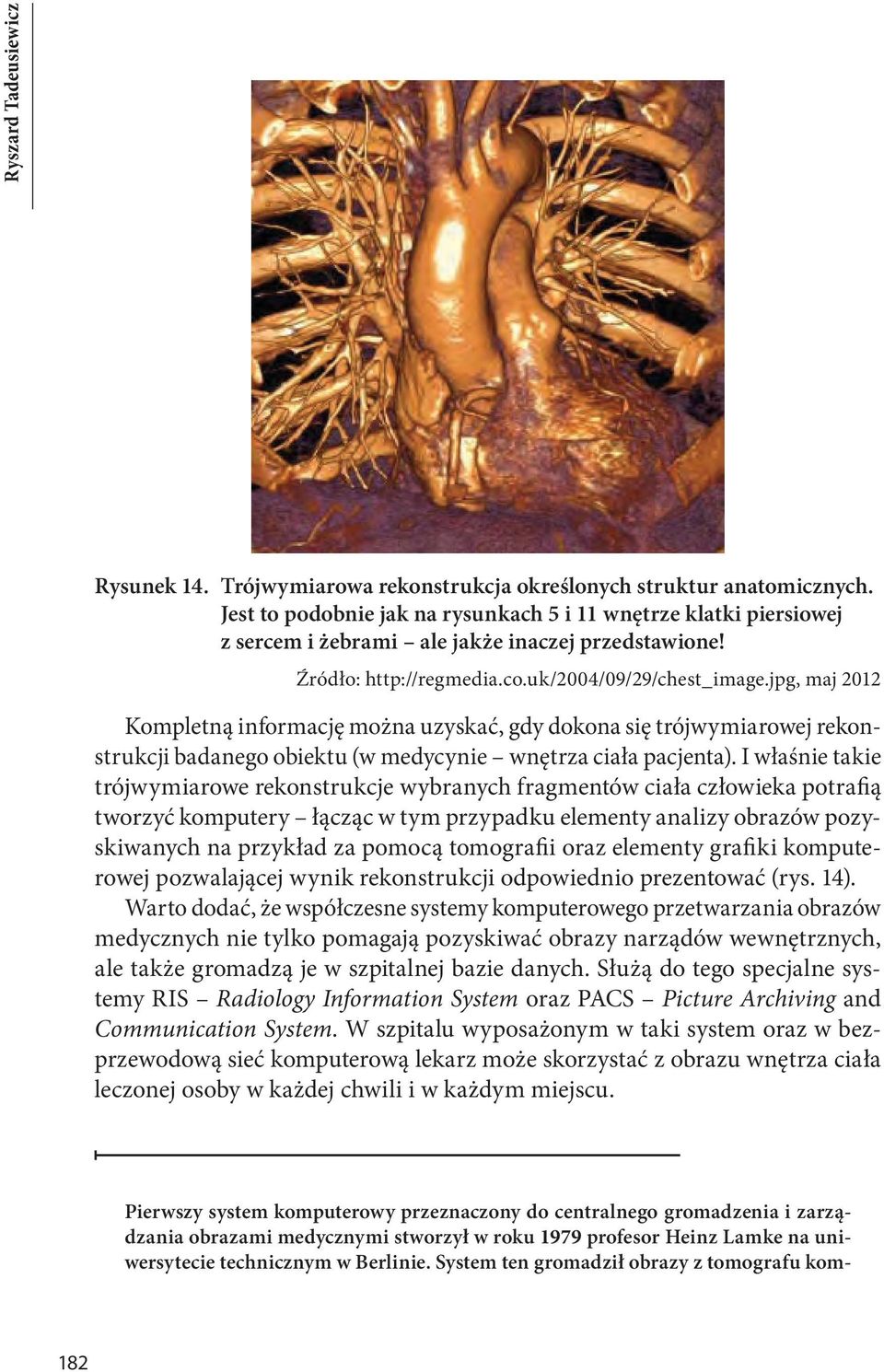 jpg, maj 2012 Kompletną informację można uzyskać, gdy dokona się trójwymiarowej rekonstrukcji badanego obiektu (w medycynie wnętrza ciała pacjenta).