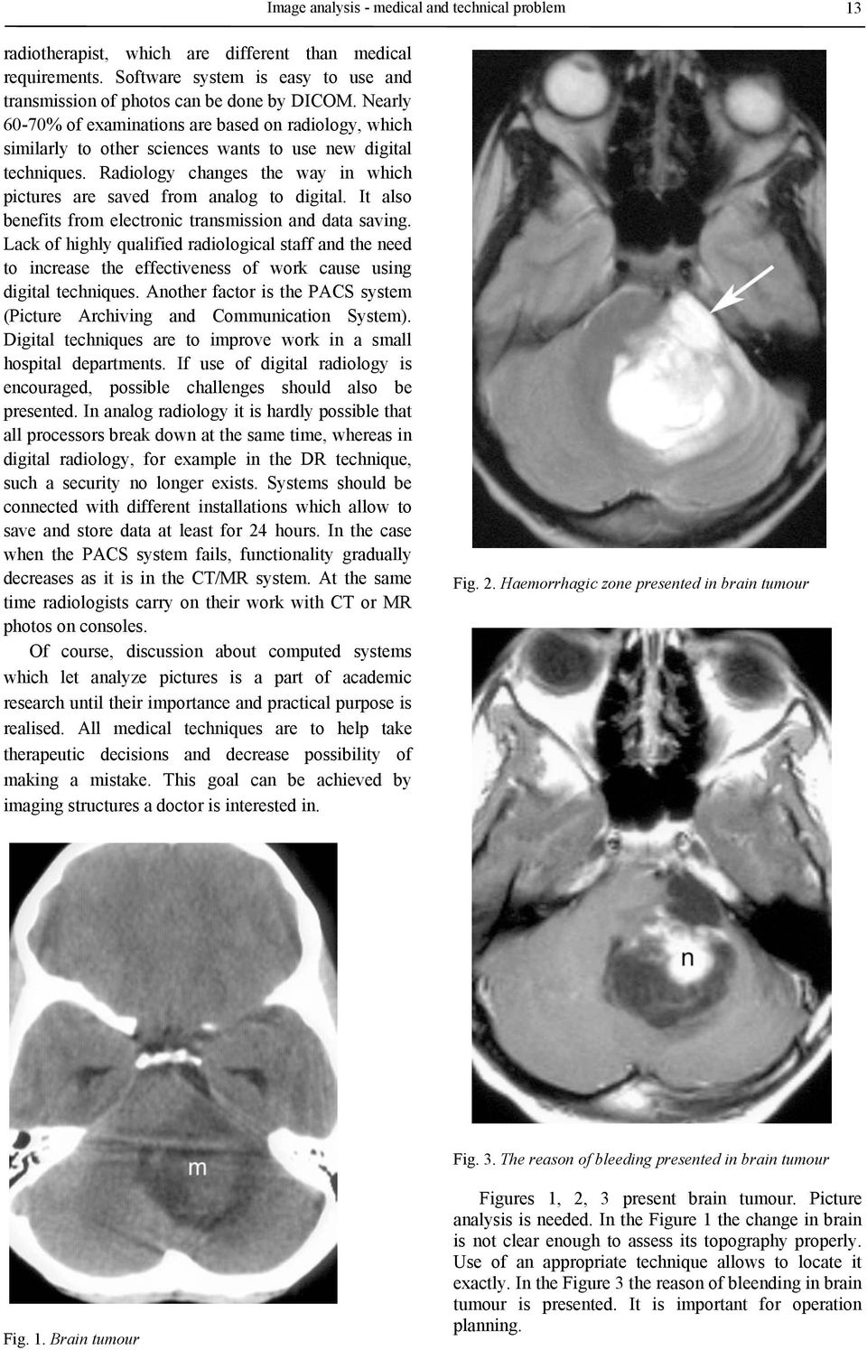 Radiology changes the way in which pictures are saved from analog to digital. It also benefits from electronic transmission and data saving.