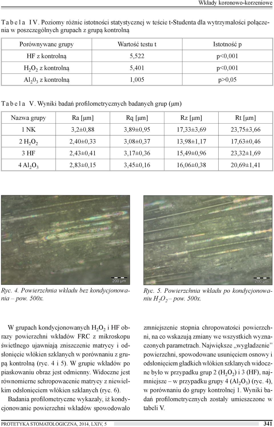 p<0,001 H 2 O 2 z kontrolną 5,401 p<0,001 Al 2 0 3 z kontrolną 1,005 p>0,05 T a b e l a V.