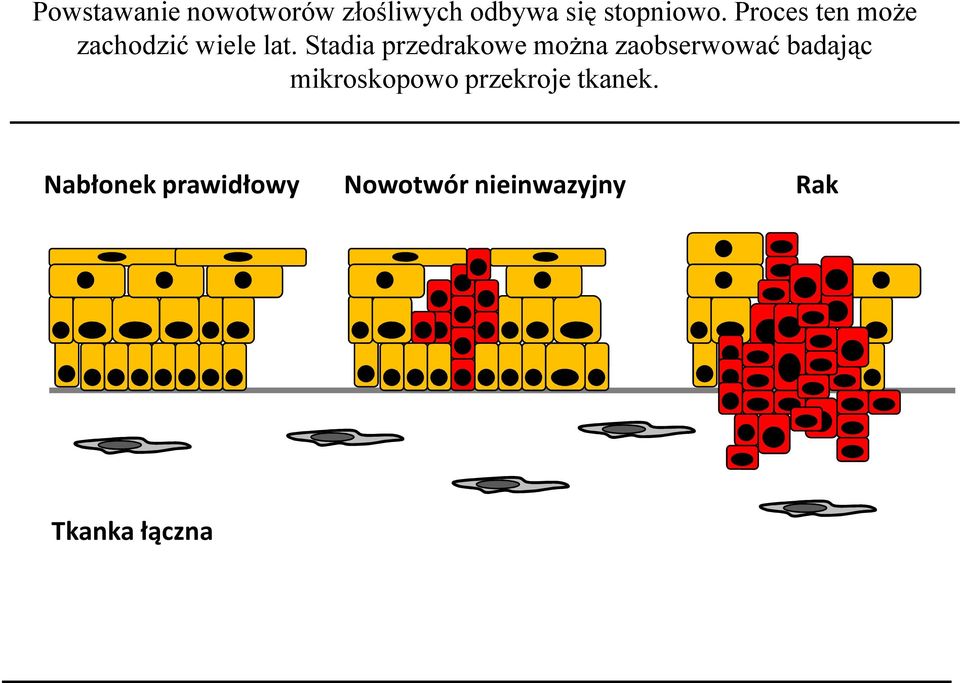 Stadia przedrakowe można zaobserwować badając