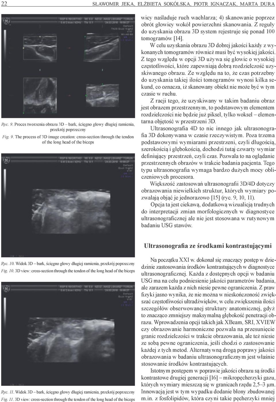 The process of 3D image creation: cross -section through the tendon of the long head of the biceps wicy naśladuje ruch wachlarza; 4) skanowanie poprzez obrót głowicy wokół powierzchni skanowania.