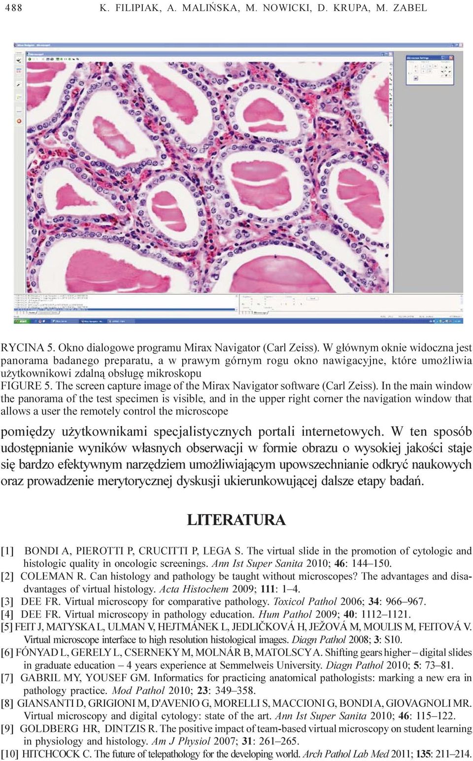 The screen capture image of the Mirax Navigator software (Carl Zeiss).