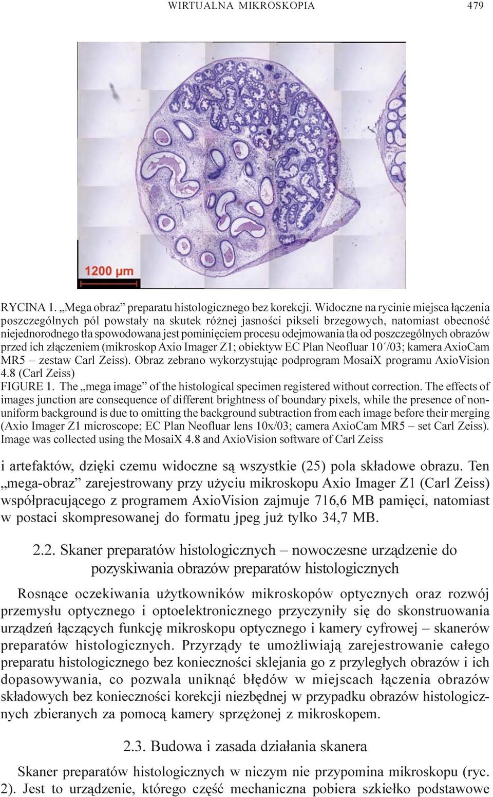 t³a od poszczególnych obrazów przed ich z³¹czeniem (mikroskop Axio Imager Z1; obiektyw EC Plan Neofluar 10 /03; kamera AxioCam MR5 zestaw Carl Zeiss).