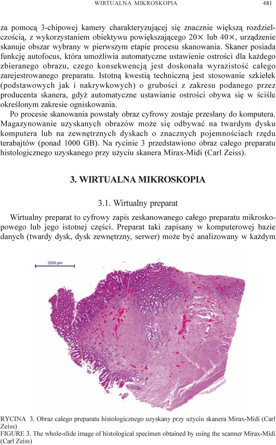 Skaner posiada funkcjê autofocus, która umo liwia automatyczne ustawienie ostroœci dla ka dego zbieranego obrazu, czego konsekwencj¹ jest doskona³a wyrazistoœæ ca³ego zarejestrowanego preparatu.