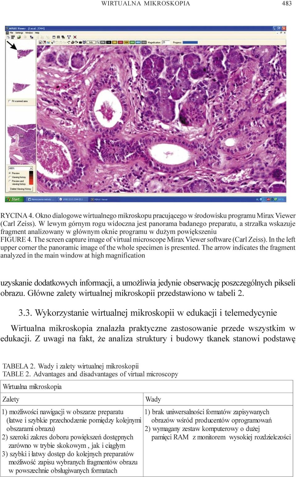 The screen capture image of virtual microscope Mirax Viewer software (Carl Zeiss). In the left upper corner the panoramic image of the whole specimen is presented.