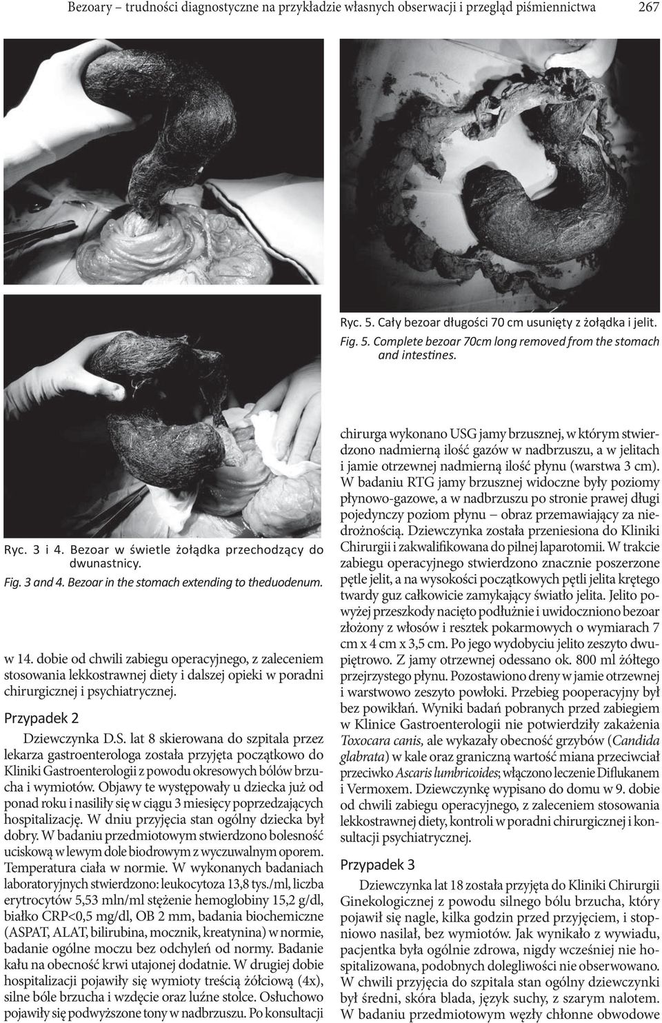 dobie od chwili zabiegu operacyjnego, z zaleceniem stosowania lekkostrawnej diety i dalszej opieki w poradni chirurgicznej i psychiatrycznej. Przypadek 2 Dziewczynka D.S.