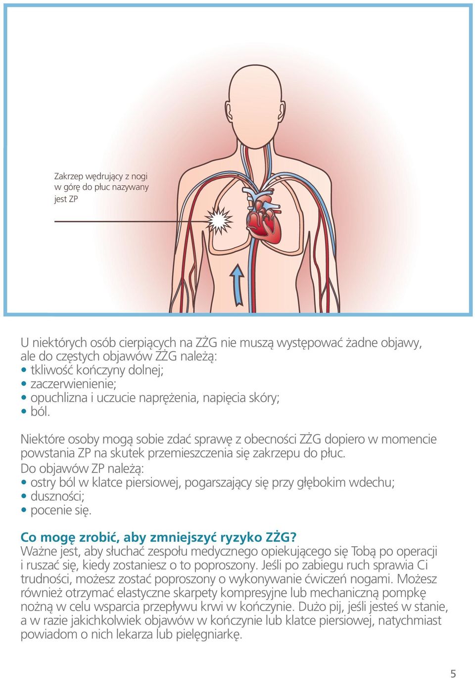 skóry; ból. Niektóre osoby mogą sobie zdać sprawę z obecności ZŻG dopiero w momencie powstania ZP na skutek przemieszczenia się zakrzepu do płuc.