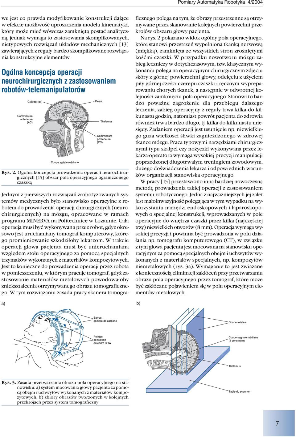 Ogólna koncepcja operacji neurochirurgicznych z zastosowaniem robotów telemanipulatorów Rys. 2.