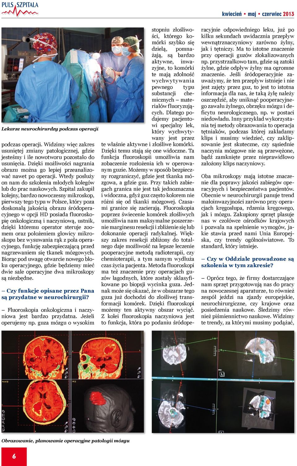 Szpital zakupił kolejny, bardzo nowoczesny mikroskop, pierwszy tego typu w Polsce, który poza doskonałą jakością obrazu śródoperacyjnego w opcji HD posiada fluoroskopię onkologiczną i naczyniową,