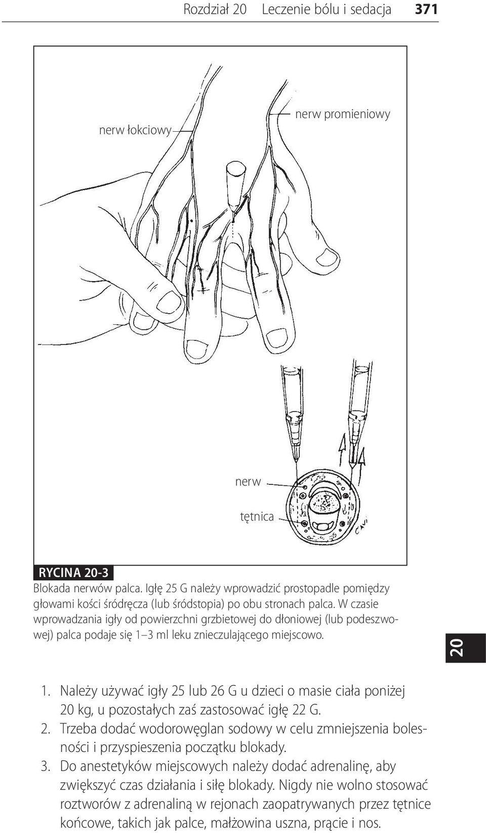 W czasie wprowadzania igły od powierzchni grzbietowej do dłoniowej (lub podeszwowej) palca podaje się 1 