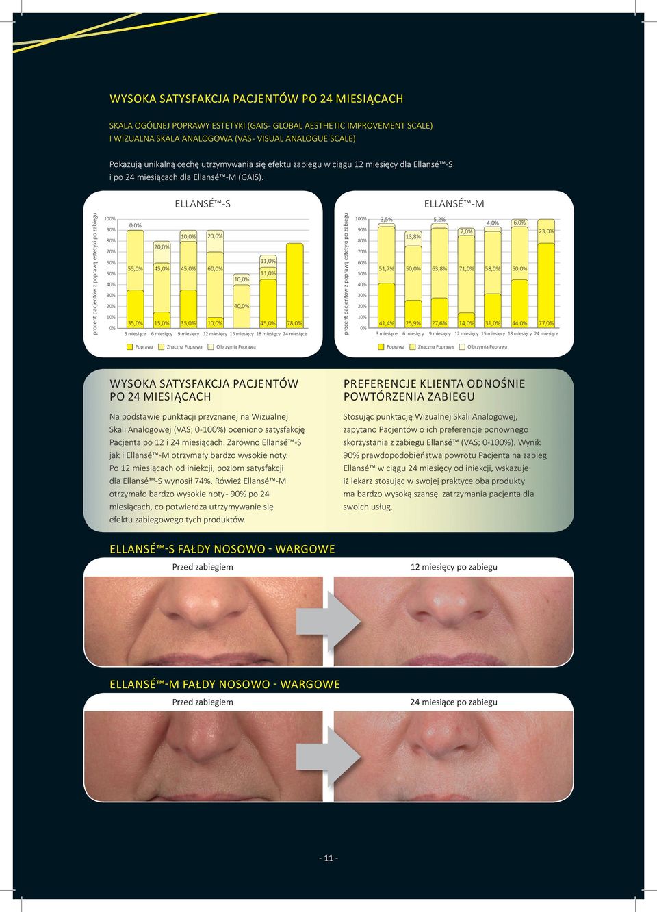 ELLANSé -S ELLANSé -M procent pacjentów z poprawą estetyki po zabiegu 100% 90% 80% 70% 60% 50% 40% 30% 20% 10% 0% 0,0% 10,0% 20,0% 20,0% 55,0% 45,0% 45,0% 60,0% 11,0% 11,0% 10,0% 40,0% 35,0% 15,0%