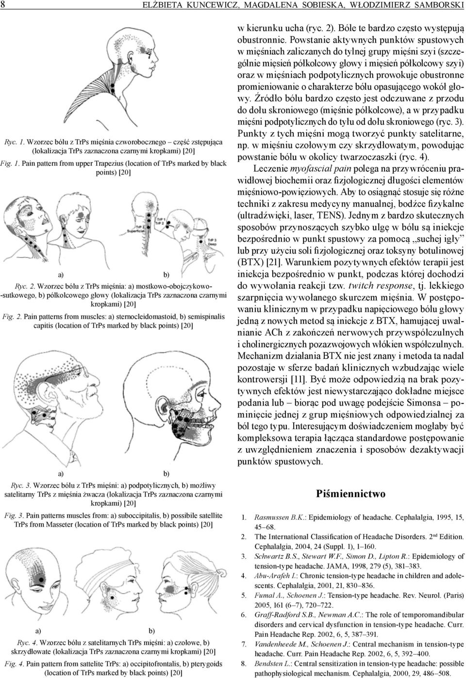 Pain patterns from muscles: a) sternocleidomastoid, b) semispinalis capitis (location of TrPs marked by black points) [20] Ryc. 3.