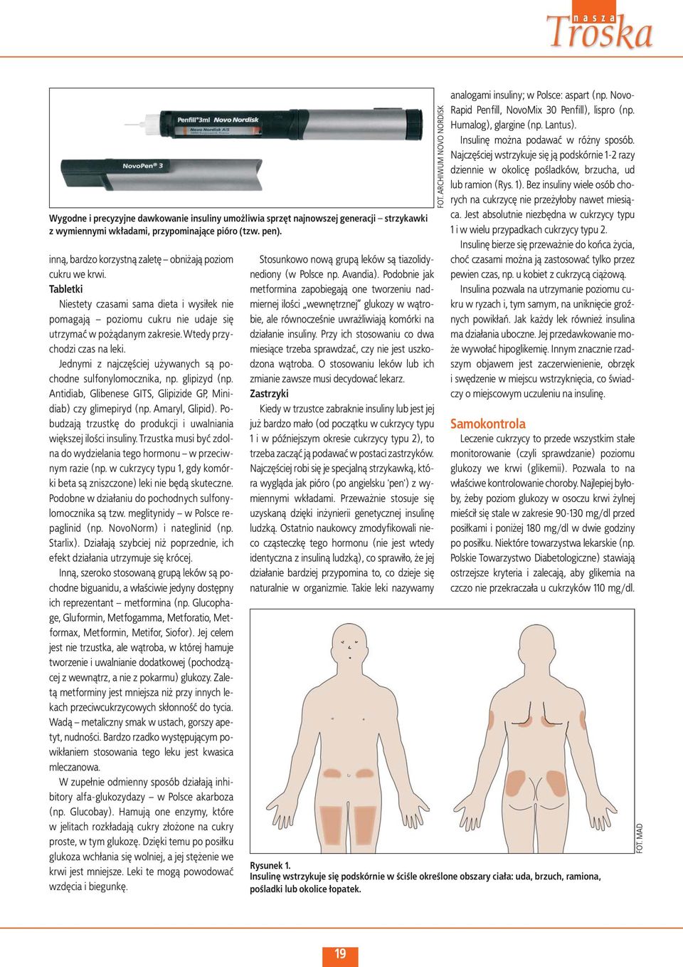 wtedy przychodzi czas na leki. Jednymi z najczęściej używanych są pochodne sulfonylomocznika, np. glipizyd (np. Antidiab, Glibenese GITS, Glipizide GP, Minidiab) czy glimepiryd (np. Amaryl, Glipid).