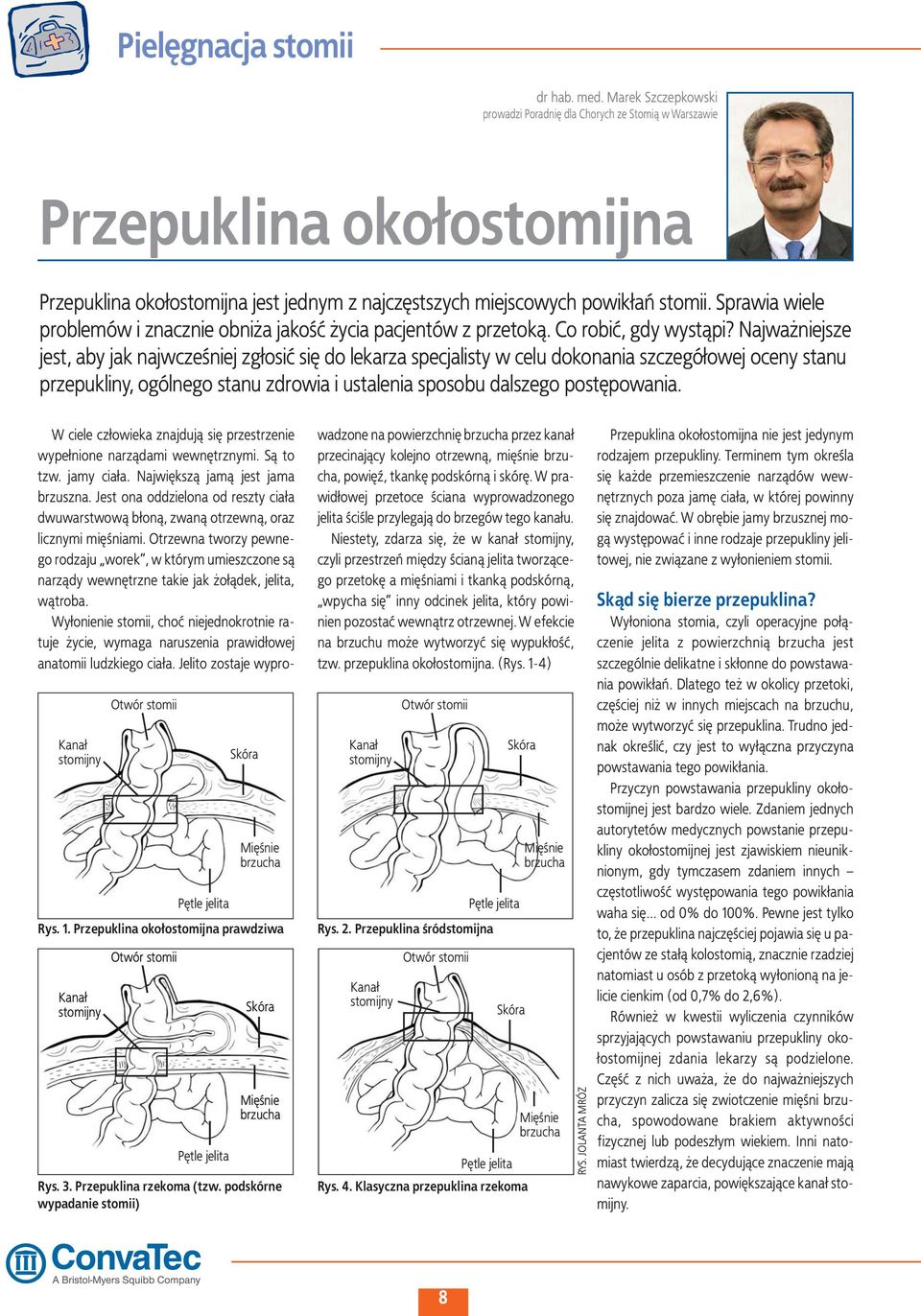 Sprawia wiele problemów i znacznie obniża jakość życia pacjentów z przetoką. Co robić, gdy wystąpi?