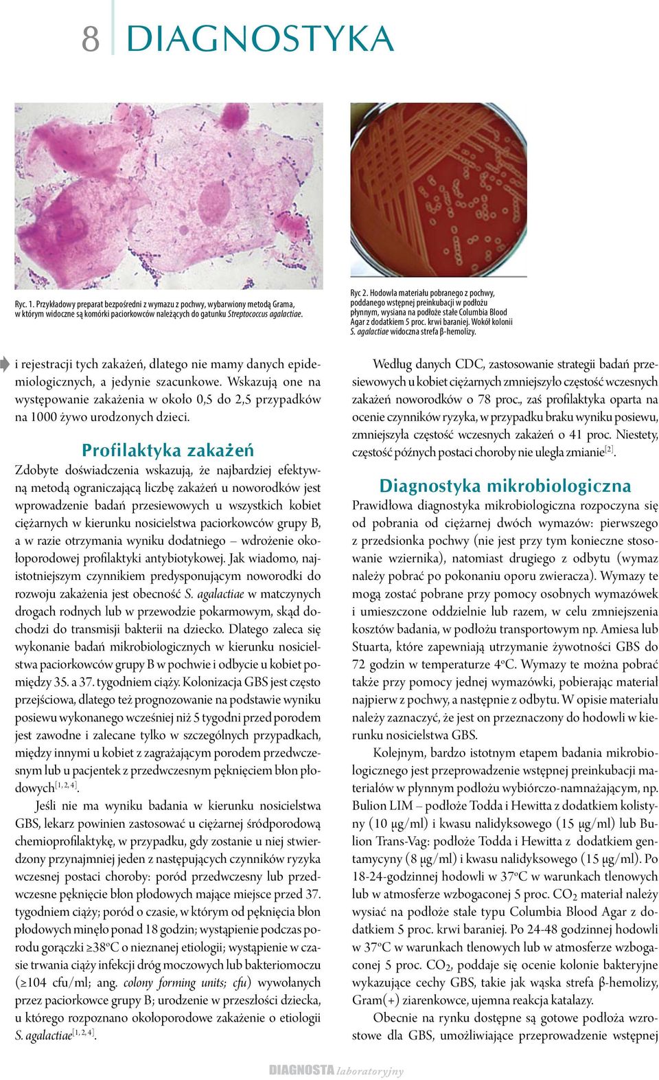 agalactiae widoczna strefa β-hemolizy. i rejestracji tych zakażeń, dlatego nie mamy danych epidemiologicznych, a jedynie szacunkowe.