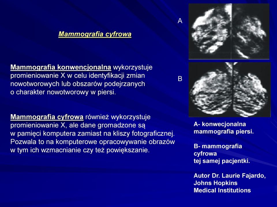 B Mammografia cyfrowa również wykorzystuje promieniowanie X, ale dane gromadzone są w pamięci komputera zamiast na kliszy fotograficznej.