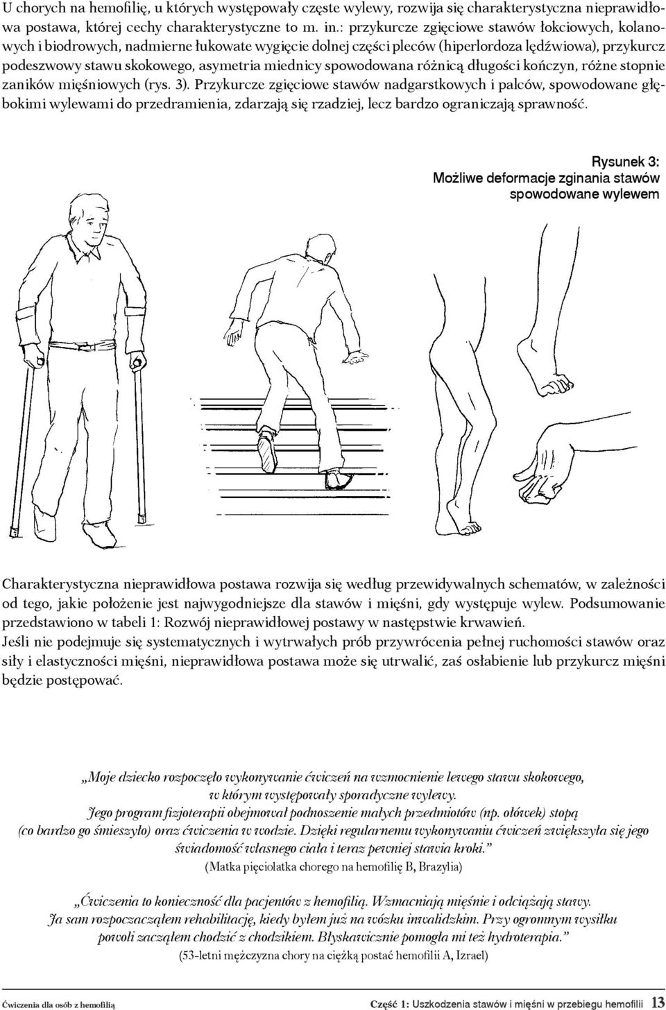 spowodowana różnicą długości kończyn, różne stopnie zaników mięśniowych (rys. 3).