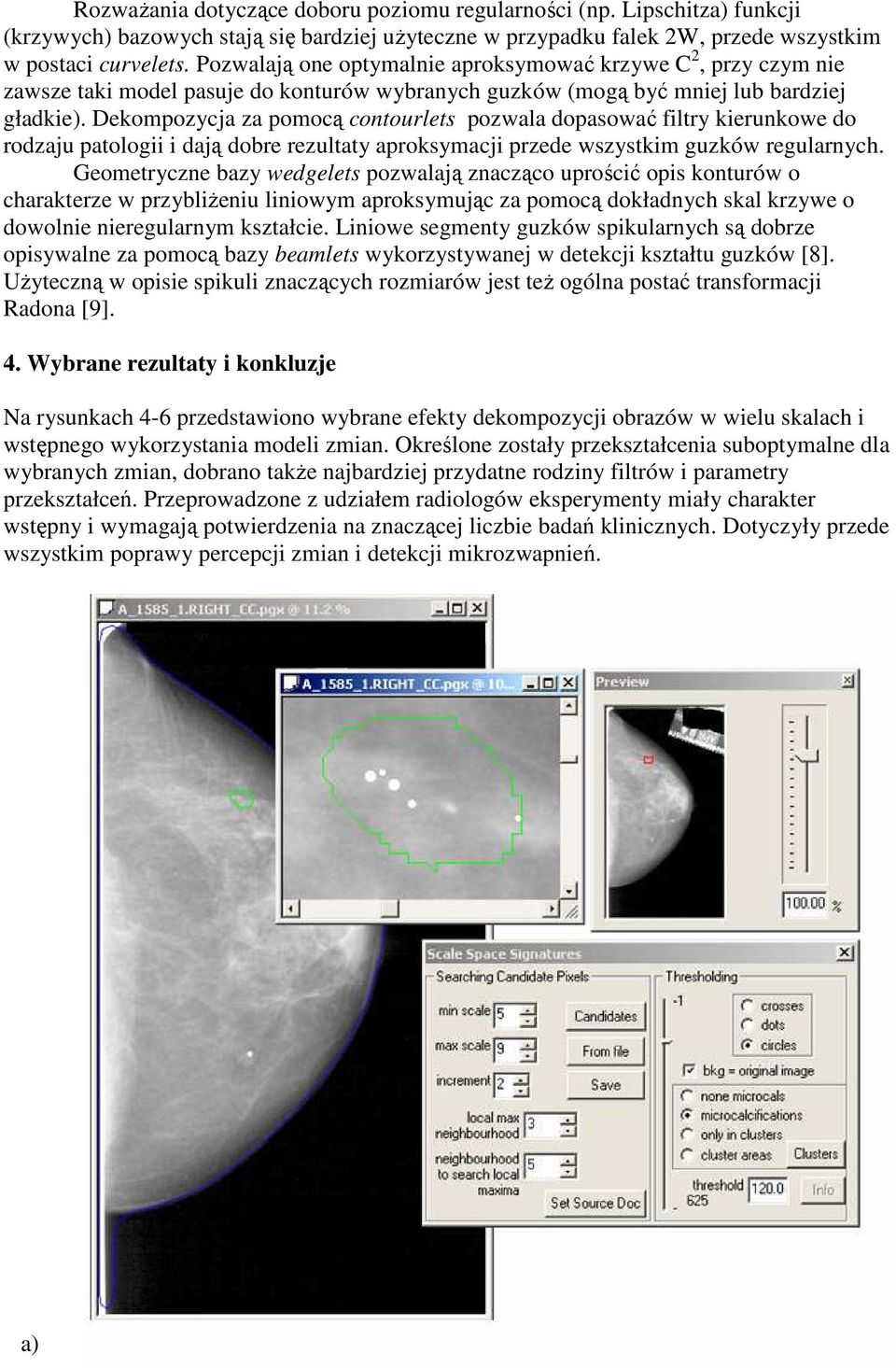 Dekompozycja za pomocą contourlets pozwala dopasować filtry kierunkowe do rodzaju patologii i dają dobre rezultaty aproksymacji przede wszystkim guzków regularnych.