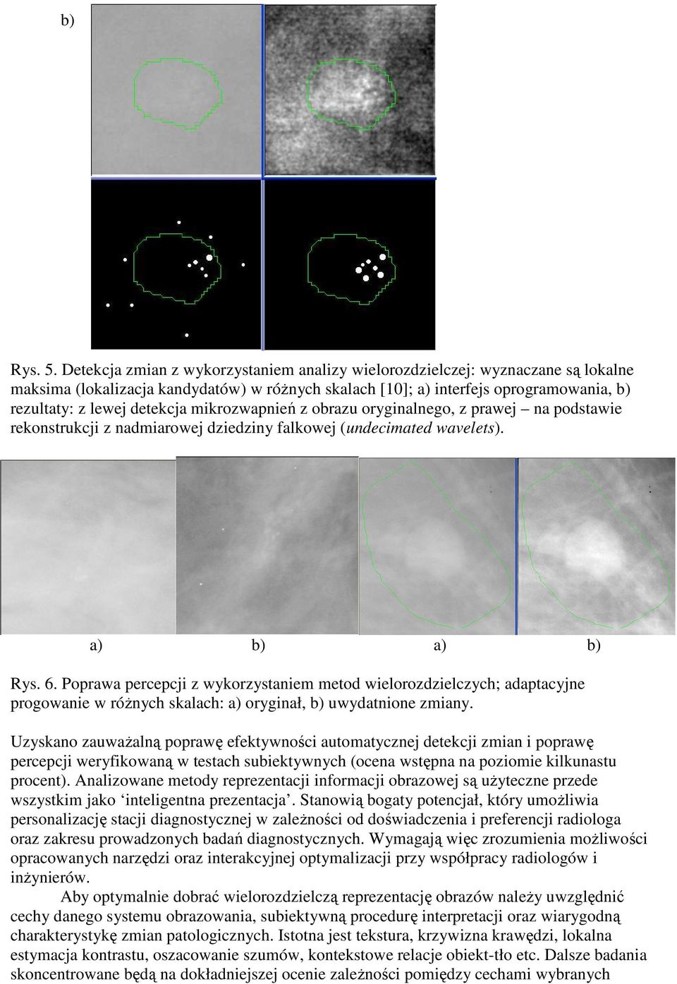 mikrozwapnień z obrazu oryginalnego, z prawej na podstawie rekonstrukcji z nadmiarowej dziedziny falkowej (undecimated wavelets). a) b) a) b) Rys. 6.