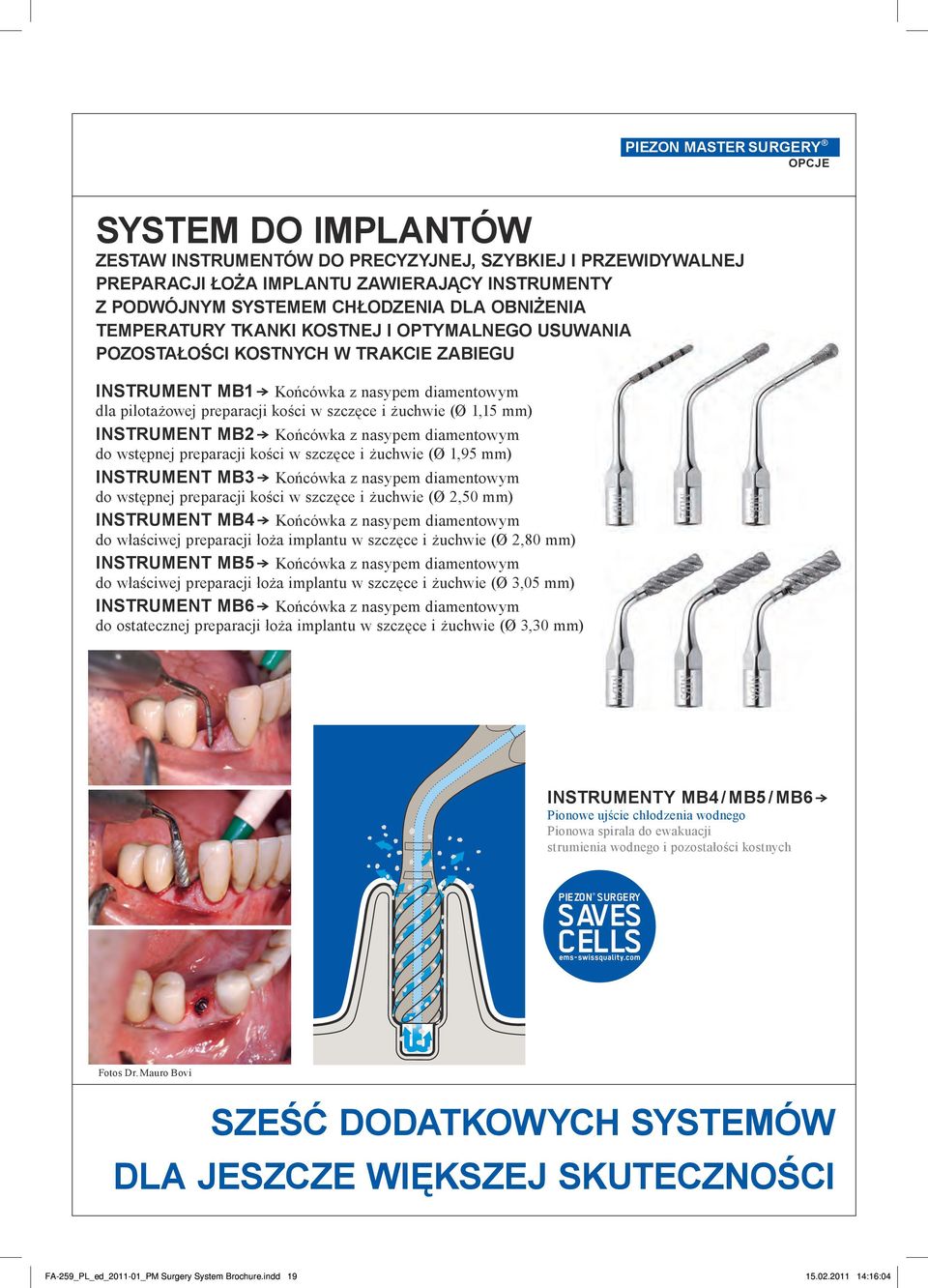 INSTRUMENT MB2 } Końcówka z nasypem diamentowym do wstępnej preparacji kości w szczęce i żuchwie (Ø 1,95 mm) INSTRUMENT MB3 } Końcówka z nasypem diamentowym do wstępnej preparacji kości w szczęce i