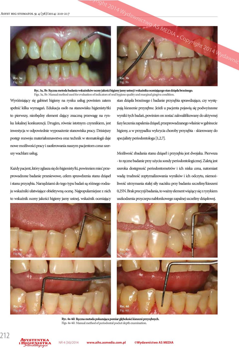 3a, 3b: Manual method used for evaluation of indicators of oral hygiene quality and marginal gingiva condition.
