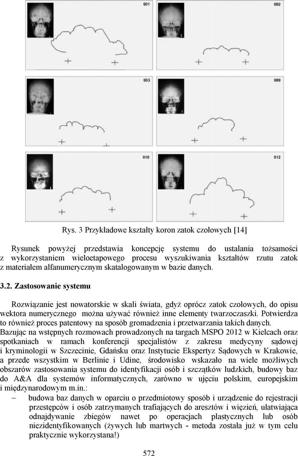 Zastosowanie systemu Rozwiązanie jest nowatorskie w skali świata, gdyż oprócz zatok czołowych, do opisu wektora numerycznego można używać również inne elementy twarzoczaszki.