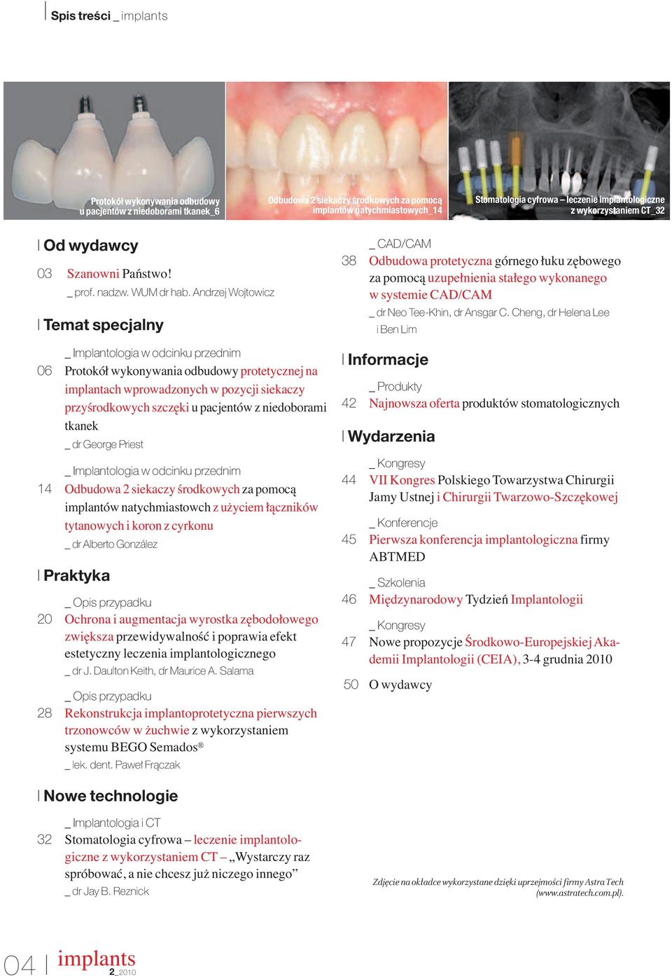 An drzej Woj to wicz I Temat specjalny _ Implantologia w odcinku przednim 06 Protokół wykonywania odbudowy protetycznej na implantach wprowadzonych w pozycji siekaczy przyśrodkowych szczęki u