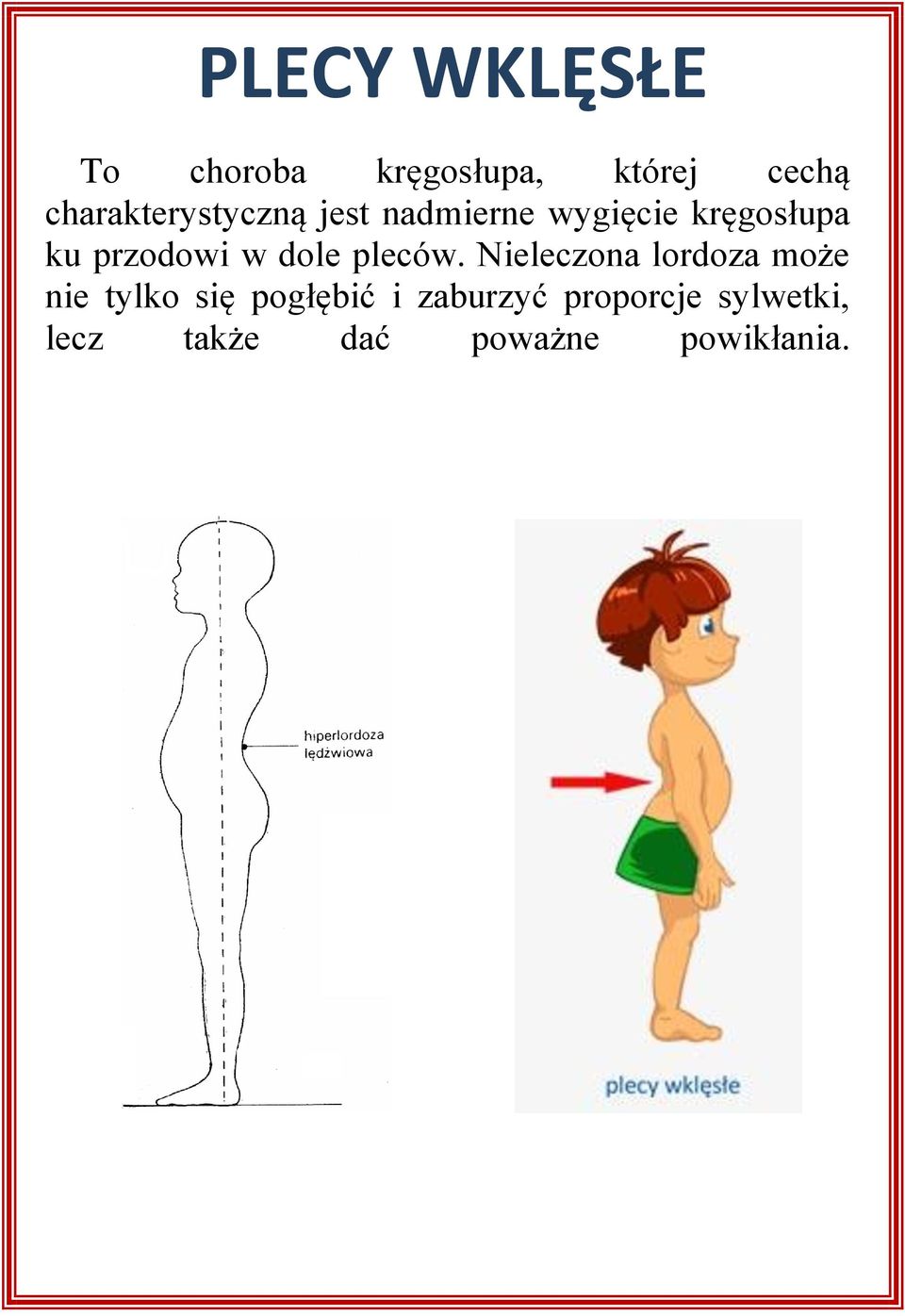 przodowi w dole pleców.