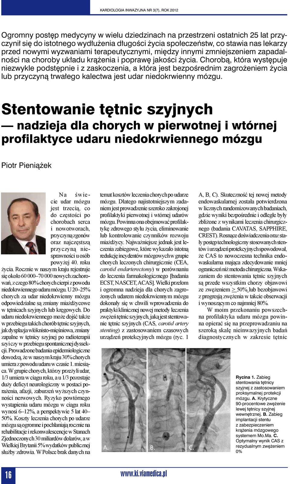 Chorobą, która występuje niezwykle podstępnie i z zaskoczenia, a która jest bezpośrednim zagrożeniem życia lub przyczyną trwałego kalectwa jest udar niedokrwienny mózgu.